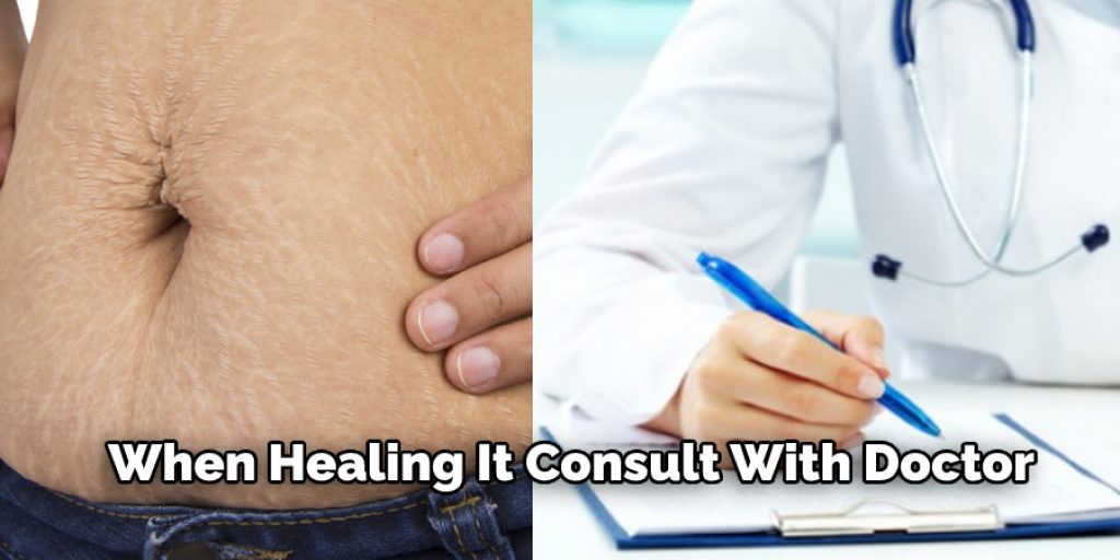 When Healing It Consult With Doctor