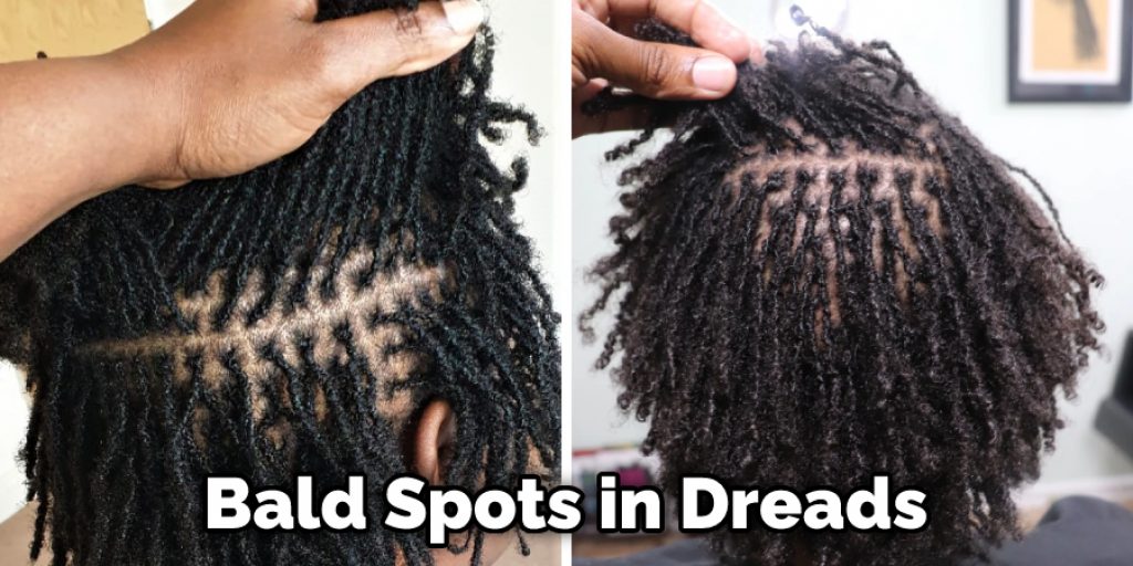 Bald Spots in Dreads