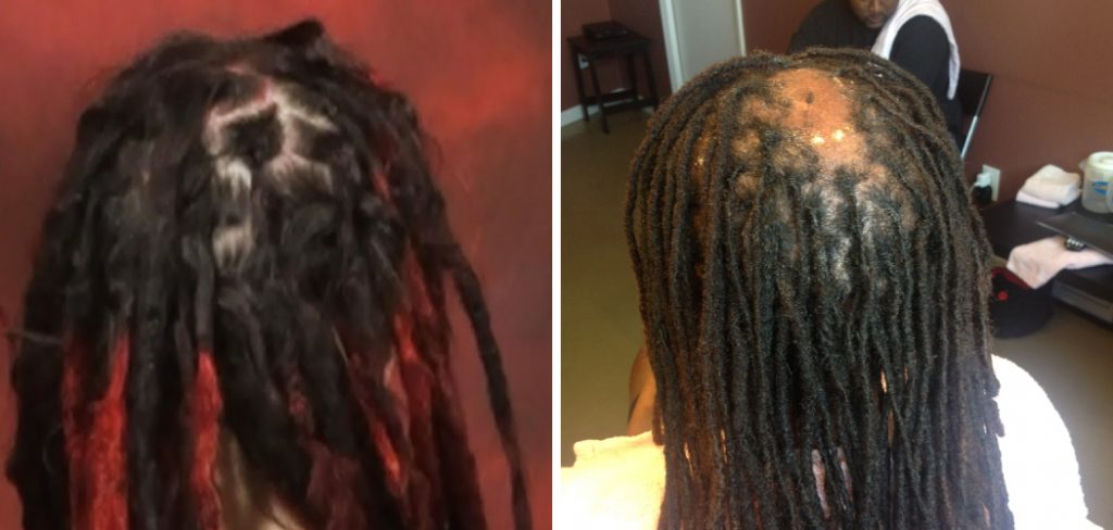 How to Fix Bald Spots in Dreads